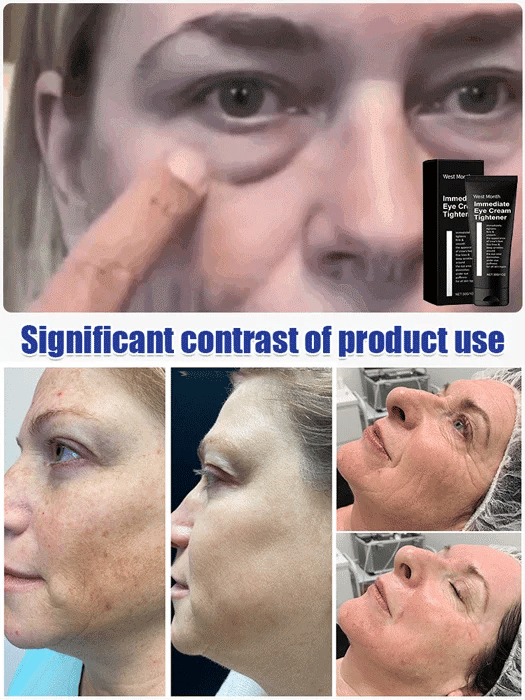 ⭐️ BUY 1 GET 1 FREE ⭐️ Firming and Moisturizing Eye Cream 📢 SAVE UP TO 67% 📢