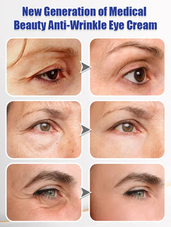 ⭐️ BUY 1 GET 1 FREE ⭐️ Firming and Moisturizing Eye Cream 📢 SAVE UP TO 67% 📢