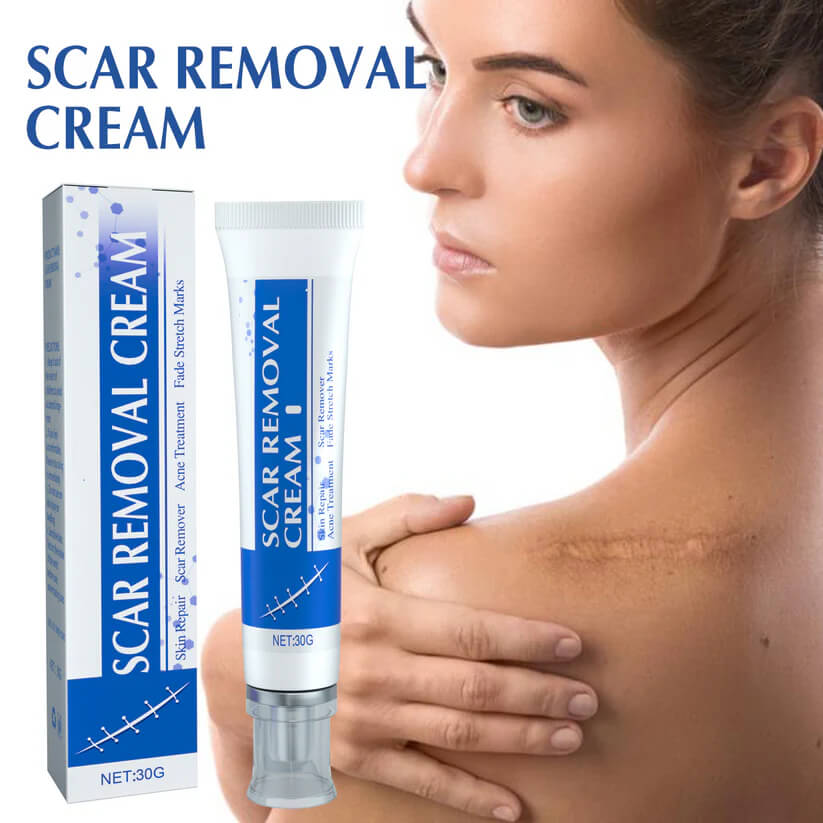 Viralaluna Scar Cream – Clear Skin Boost 🌸