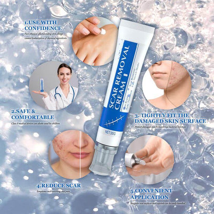 Viralaluna Scar Cream – Clear Skin Boost 🌸