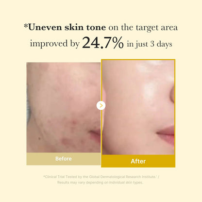 Wake Up To Clearer Skin With KOJIC ACID TURMERIC WRAPPING MASK