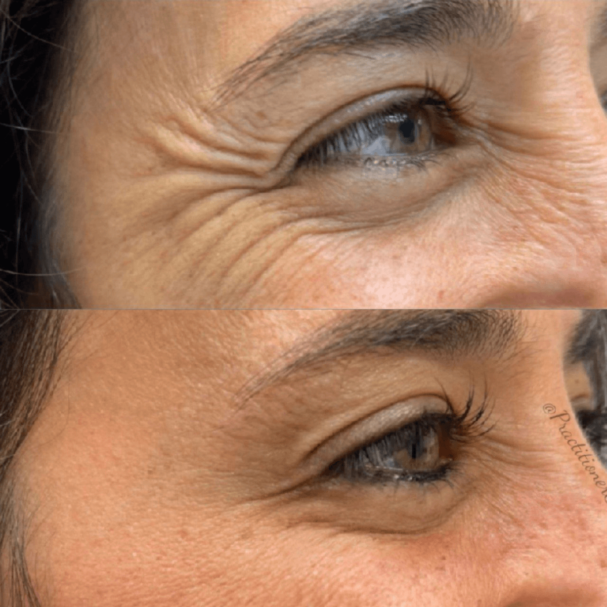 Luxevéria | Erase 98% of Wrinkles & Look 15 Years Younger in Just 7 Days!