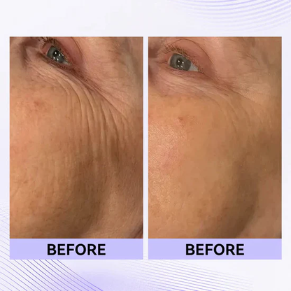 🔥 70% OFF! 🌸 Perfection Primer Tightener – New Formula, Ultimate Lift & Smooth Finish ✨ Today Only!