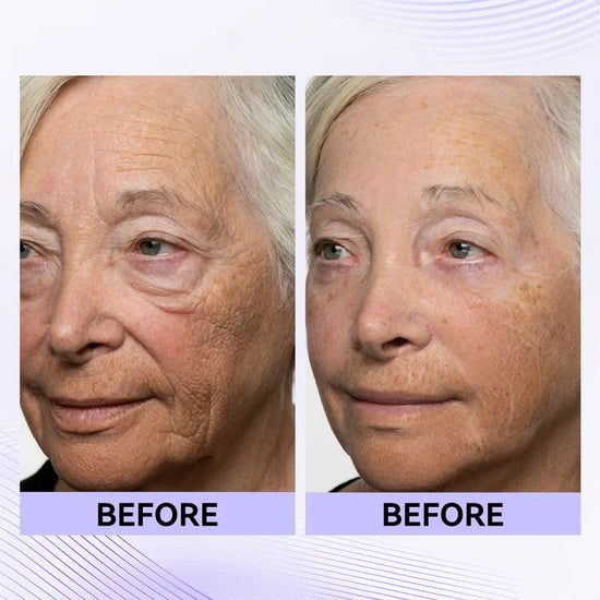 🔥 70% OFF! 🌸 Perfection Primer Tightener – New Formula, Ultimate Lift & Smooth Finish ✨ Today Only!