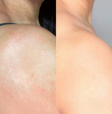 FerméLuxe | Firms sagging skin by 98% in 24 hours.