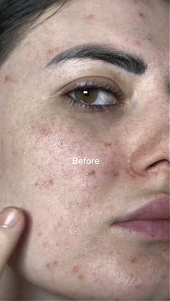 💥 Salmon DNA Bounce Serum – Lift, Repair & Restore Youthful Glow 🌟