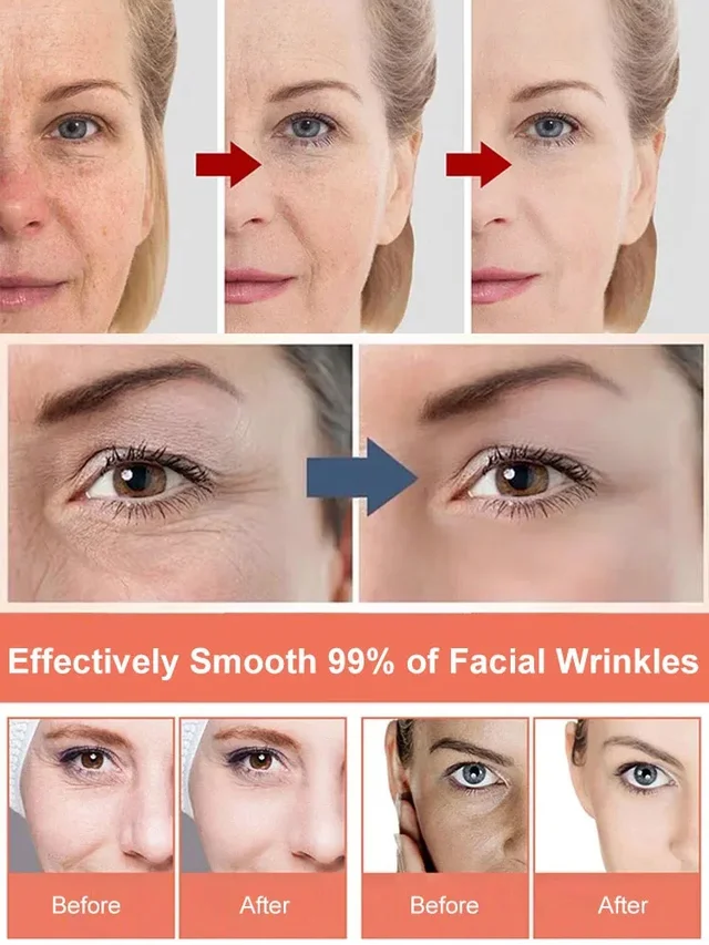 [Anti-Wrinkle and Yellowing Reduction] Professional Facial Anti-Wrinkle Cream