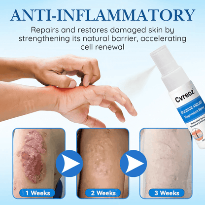 ✅DOCTOR RECOMMENDED + 20,000+ SUCCESS STORIES🎯Cvreoz® Source-Relief Magnesium Spray