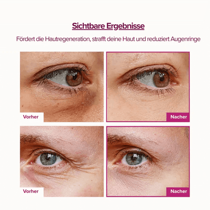 🏆Hot Sale⚡Anti-Aging Multi-Balm Stick - Wrinkle Care for Face, Lips & Eyes