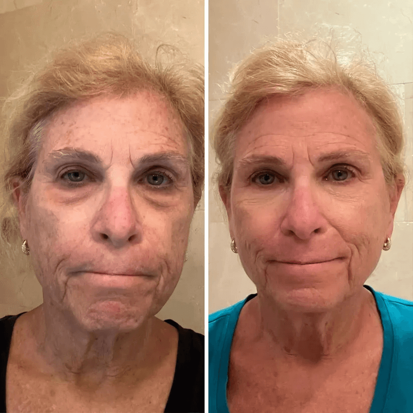 💥 Under-Eye Renewal Balm — Black Friday Special: 50% OFF!
