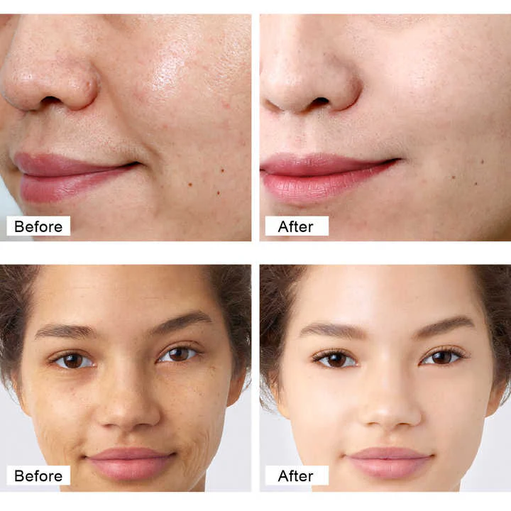Anti-aging Face Cream