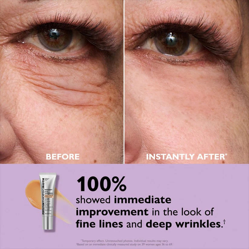 ⚡ 60-Second Instant Eye Tightener