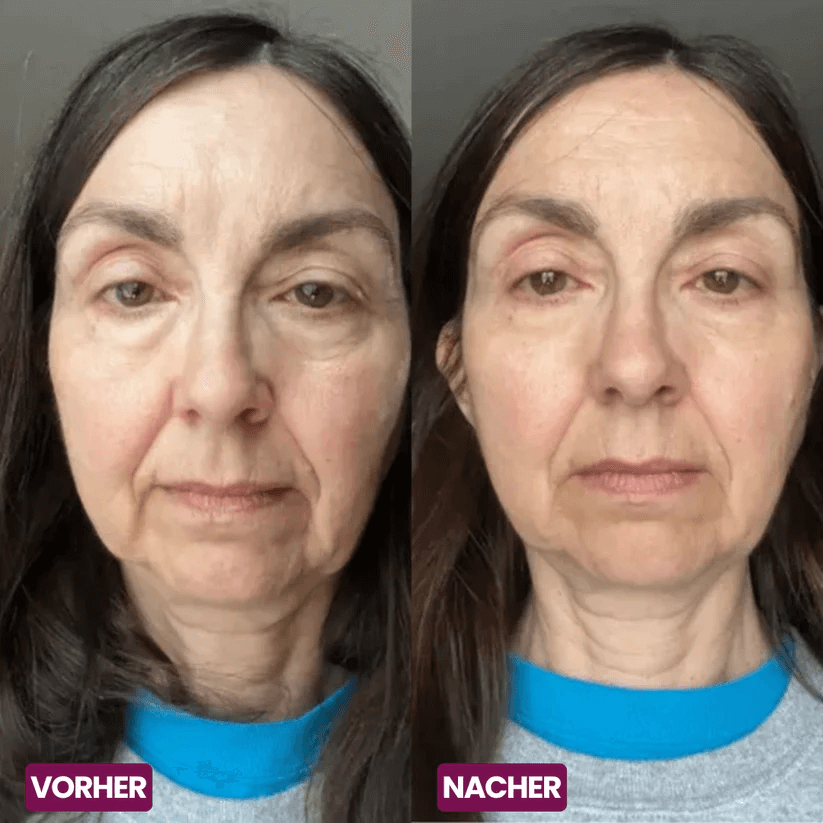 🏆Hot Sale⚡Anti-Aging Multi-Balm Stick - Wrinkle Care for Face, Lips & Eyes