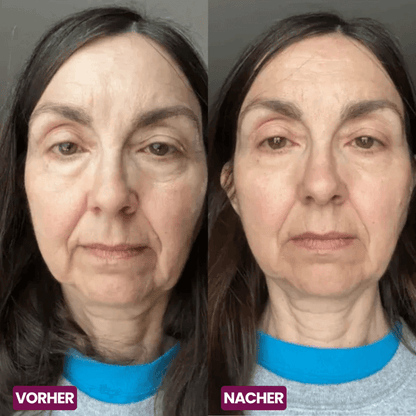 🏆Hot Sale⚡Anti-Aging Multi-Balm Stick - Wrinkle Care for Face, Lips & Eyes