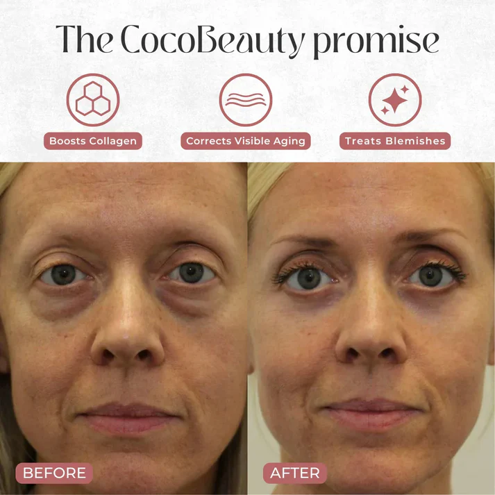 ⭐⭐💧Neck-Eye Care Tightening & Revitalizing Set