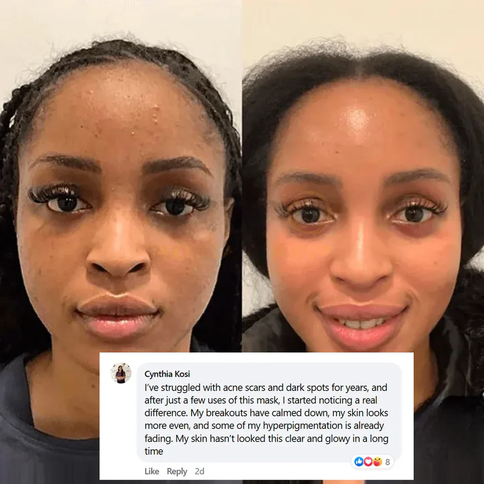 🔥 Buy 2 Collagen Night Masks, Get 1 Free! 🔥 Wake Up to Youthful, Hydrated Skin – Limited Time Offer! 💖