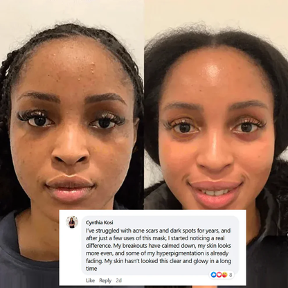 🔥 Buy 2 Collagen Night Masks, Get 1 Free! 🔥 Wake Up to Youthful, Hydrated Skin – Limited Time Offer! 💖