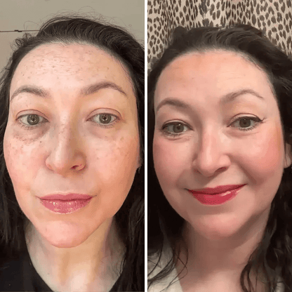 💥 Under-Eye Renewal Balm — Black Friday Special: 50% OFF!