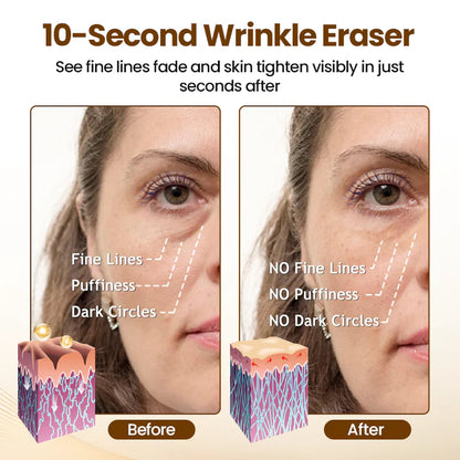 Newyuo Renewing 10s Wrinkle Serum