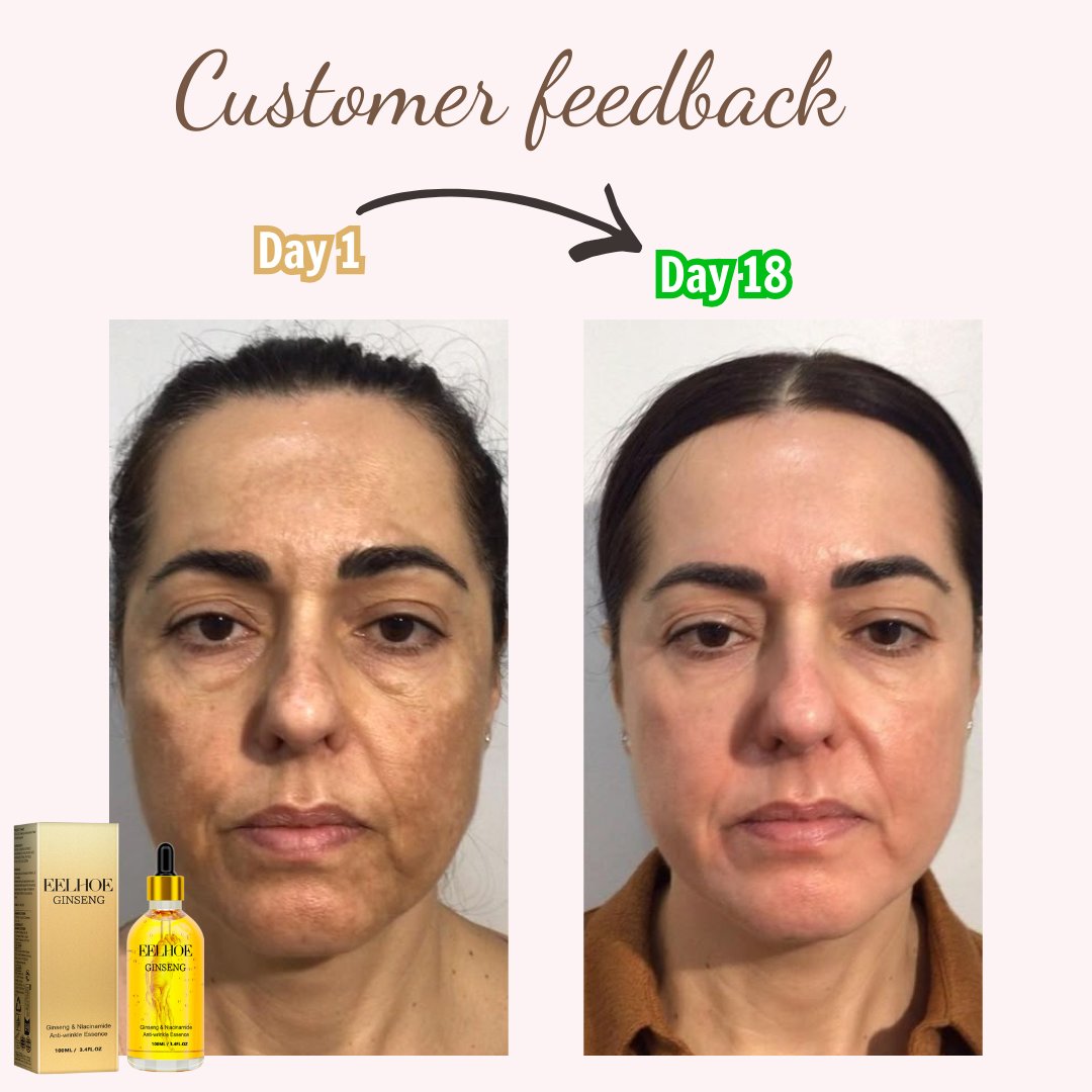 Ginseng Polypeptide Anti-Ageing Essence-The Secret of Youth