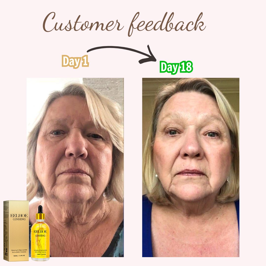 Ginseng Polypeptide Anti-Ageing Essence-The Secret of Youth