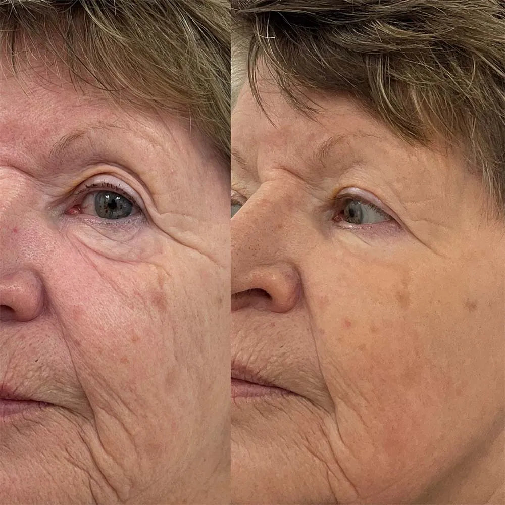 🔥 HOT SALE! ✨ Silk Lifting Peptide Ampoule – Korean Anti-Aging Serum for Instant Wrinkle Reduction & Plumping Results! 💧