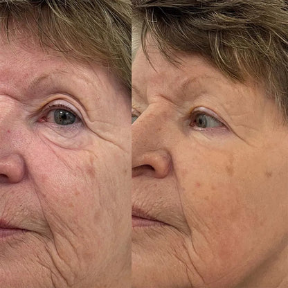 🔥 HOT SALE! ✨ Silk Lifting Peptide Ampoule – Korean Anti-Aging Serum for Instant Wrinkle Reduction & Plumping Results! 💧