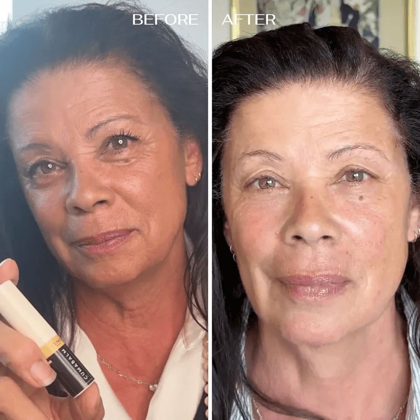 💥 Under-Eye Renewal Balm — Black Friday Special: 50% OFF!