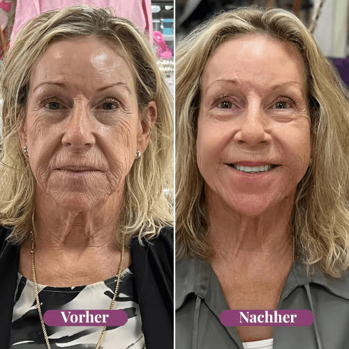 🏆Hot Sale⚡Anti-Aging Multi-Balm Stick - Wrinkle Care for Face, Lips & Eyes