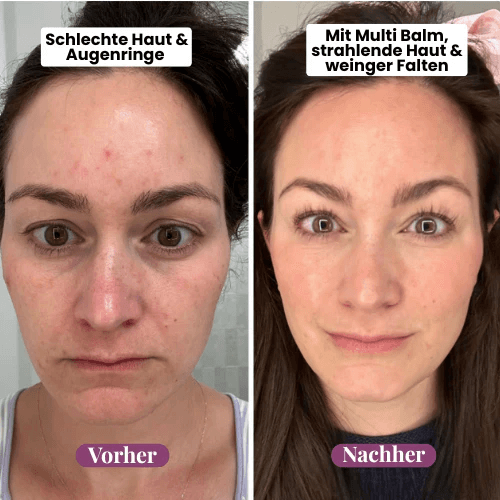 🏆Hot Sale⚡Anti-Aging Multi-Balm Stick - Wrinkle Care for Face, Lips & Eyes