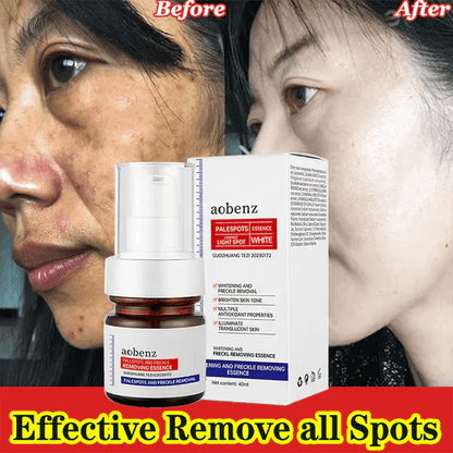 🔥Vitamin C Whitening Freckles Face Cream Remove Melasma Dark Spots Lighten Melanin