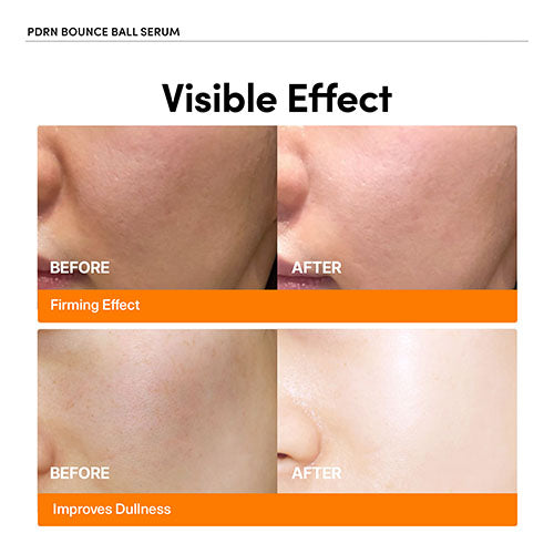 💥 Salmon DNA Bounce Serum – Lift, Repair & Restore Youthful Glow 🌟