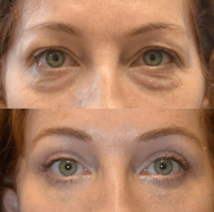Luxevéria | Erase 98% of Wrinkles & Look 15 Years Younger in Just 7 Days!