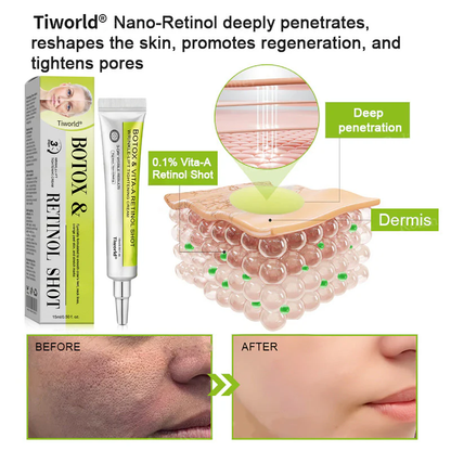 👏🌿Made and shipped from the USA 💫Tiworld® Botox & Vita-A Retinol Shot Wrinkle-Lift Tightening cream - Last Day Promotion 70% OFF