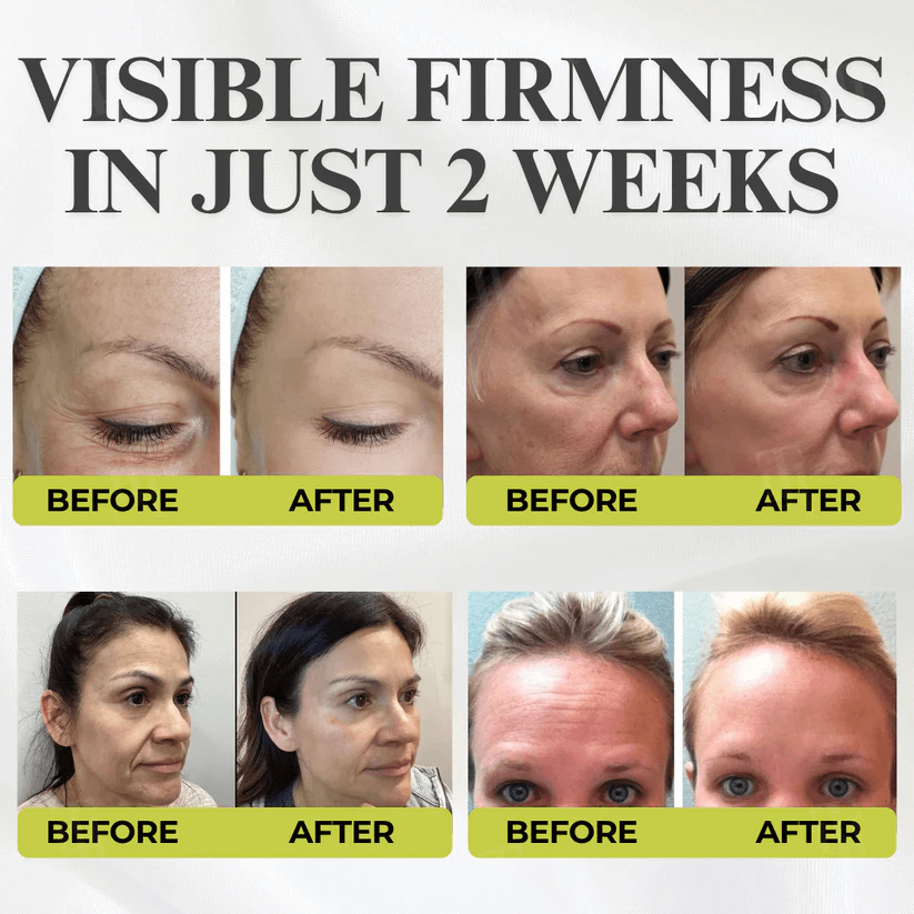 ⏰ FLASH SALE: 72-Hour Wrinkle Eraser | Botox & Vita-A Retinol Shot Wrinkle - Lift Tightening Cream