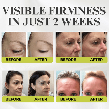 ⏰ FLASH SALE: 72-Hour Wrinkle Eraser | Botox & Vita-A Retinol Shot Wrinkle - Lift Tightening Cream