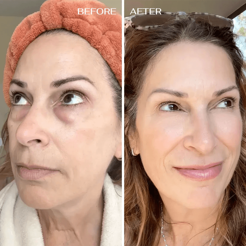 💥 Under-Eye Renewal Balm — Black Friday Special: 50% OFF!