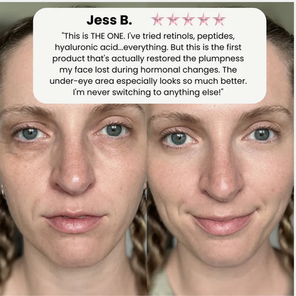Korean Collagen Boosting Anti-Wrinkle Serum – Volufiline, Elasticity & Glass Skin Hydration