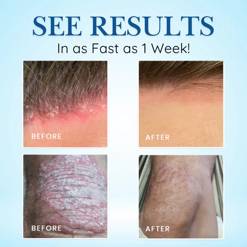 ✅DOCTOR RECOMMENDED + 20,000+ SUCCESS STORIES🎯Cvreoz® Source-Relief Magnesium Spray