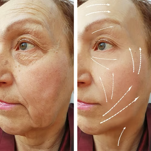 Anti-Aging Essence with Wild Ginseng