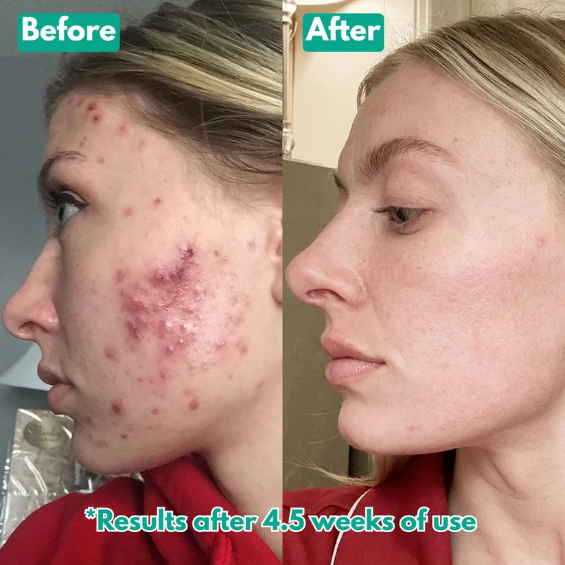 🏆Flash Sale⚡ Microcrysta  Serum PM Duo