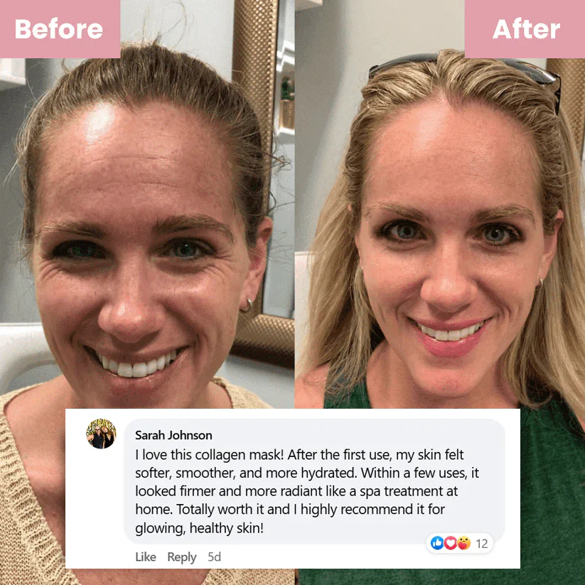 🔥 Buy 2 Collagen Night Masks, Get 1 Free! 🔥 Wake Up to Youthful, Hydrated Skin – Limited Time Offer! 💖