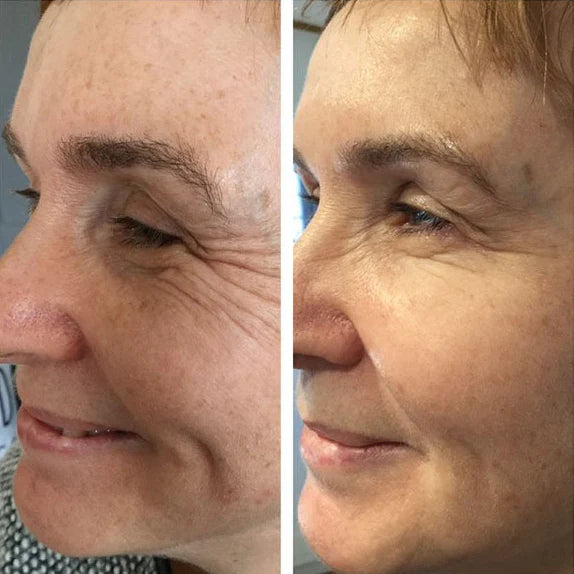 🔥 HOT SALE! ✨ Silk Lifting Peptide Ampoule – Korean Anti-Aging Serum for Instant Wrinkle Reduction & Plumping Results! 💧